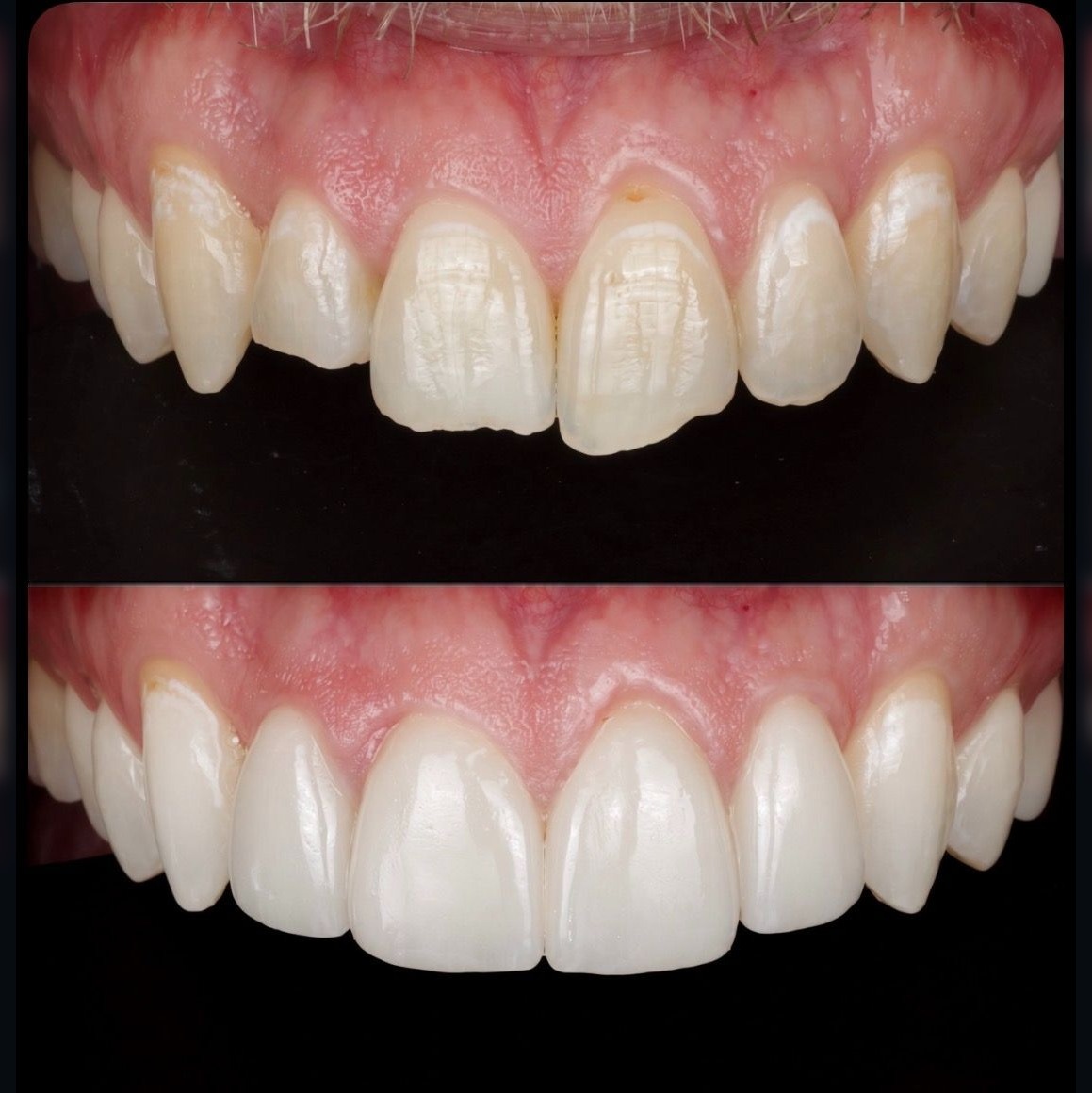 B/ARTistry Systems case — before and after